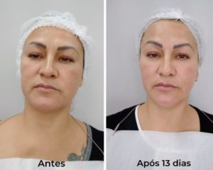 Royal Face Pinheiros SP