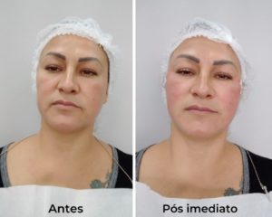 Royal Face Pinheiros SP