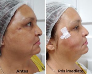 Royal Face Pinheiros SP