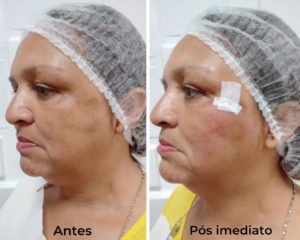 Royal Face Pinheiros SP