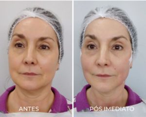 Royal Face Pinheiros SP