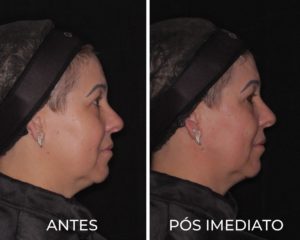 Royal Face Pinheiros SP