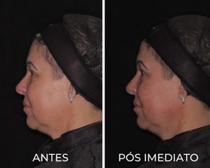 Royal Face Pinheiros SP