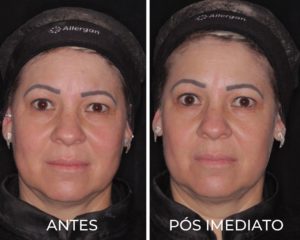 Royal Face Pinheiros SP