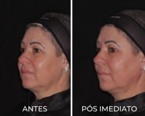 Royal Face Pinheiros SP