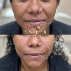 Royal Face Pinheiros SP
